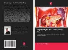 Buchcover von Implantação Bio-Artificial de Rins