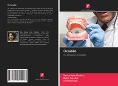Bookcover of Oclusão