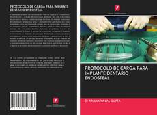 Buchcover von PROTOCOLO DE CARGA PARA IMPLANTE DENTÁRIO ENDOSTEAL