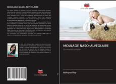 Bookcover of MOULAGE NASO-ALVÉOLAIRE