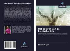 Buchcover von Het bouwen van de Bionische Knie