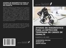 Couverture de AYUDAS DE DIAGNÓSTICO PARA LA DETECCIÓN TEMPRANA DE CARIES DE ESMALTE