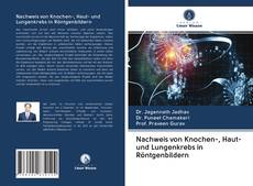 Capa do livro de Nachweis von Knochen-, Haut- und Lungenkrebs in Röntgenbildern 