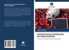 Bookcover of KRANIOFAZIALE ANOMALIEN BEI ERWACHSENEN