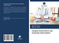 Bookcover of Jüngste Fortschritte in der Implantat-Zahnmedizin