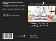 Avances recientes en la odontología de implantes kitap kapağı