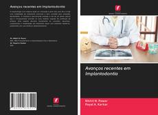 Buchcover von Avanços recentes em Implantodontia