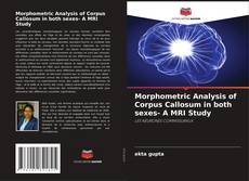 Portada del libro de Morphometric Analysis of Corpus Callosum in both sexes- A MRI Study