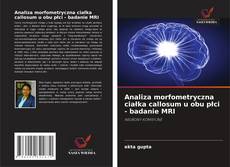 Bookcover of Analiza morfometryczna ciałka callosum u obu płci - badanie MRI