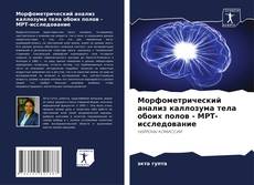 Buchcover von Морфометрический анализ каллозума тела обоих полов - МРТ-исследование