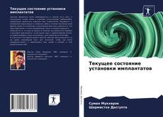 Bookcover of Текущее состояние установки имплантатов