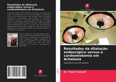 Copertina di Resultados da dilatação endoscópica versus a cardiomiotomia em Achalasia