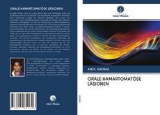 Bookcover of ORALE HAMARTOMATÖSE LÄSIONEN