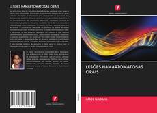 Bookcover of LESÕES HAMARTOMATOSAS ORAIS
