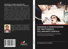 Bookcover of DIAGNOSI E PIANIFICAZIONE DEL TRATTAMENTO DELL'IMPIANTO DENTALE