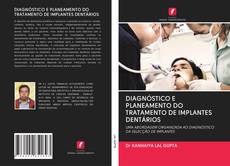 Copertina di DIAGNÓSTICO E PLANEAMENTO DO TRATAMENTO DE IMPLANTES DENTÁRIOS