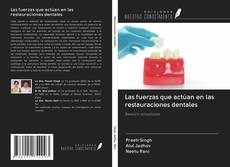 Bookcover of Las fuerzas que actúan en las restauraciones dentales