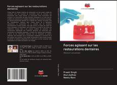 Bookcover of Forces agissant sur les restaurations dentaires