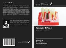 Capa do livro de Implantes dentales 
