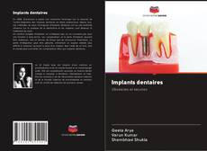 Capa do livro de Implants dentaires 
