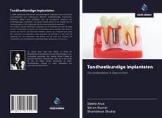Buchcover von Tandheelkundige implantaten