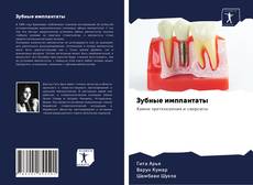 Bookcover of Зубные имплантаты