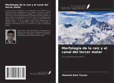 Buchcover von Morfología de la raíz y el canal del tercer molar