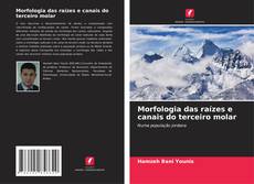 Bookcover of Morfologia das raízes e canais do terceiro molar