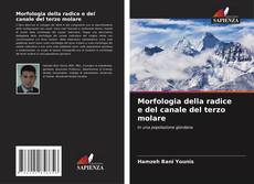 Morfologia della radice e del canale del terzo molare的封面