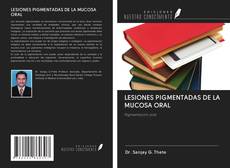 Buchcover von LESIONES PIGMENTADAS DE LA MUCOSA ORAL
