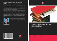 Bookcover of LESÕES PIGMENTADAS DA MUCOSA ORAL