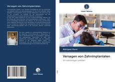 Versagen von Zahnimplantaten kitap kapağı