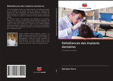 Bookcover of Défaillances des implants dentaires