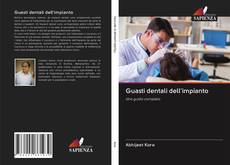 Bookcover of Guasti dentali dell'impianto