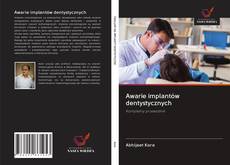 Bookcover of Awarie implantów dentystycznych