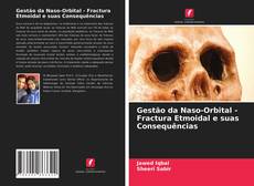 Buchcover von Gestão da Naso-Orbital - Fractura Etmoidal e suas Consequências