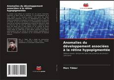 Обложка Anomalies du développement associées à la rétine hypopigmentée