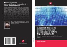 Capa do livro de Anormalidades de desenvolvimento associadas à retina hipopigmentada 
