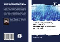 Bookcover of Аномалии развития, связанные с гипопигментированной сетчаткой