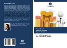 Buchcover von Apikale Extrusion