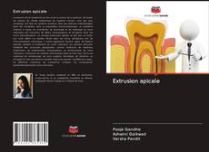 Buchcover von Extrusion apicale