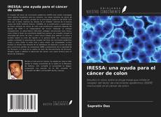 Buchcover von IRESSA: una ayuda para el cáncer de colon