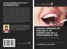 Copertina di CAUSAS COMUNES DE FRACASO Y SU CORRECCIÓN EN LA PROSTODONCIA FIJA