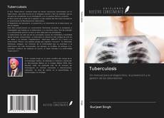 Portada del libro de Tuberculosis
