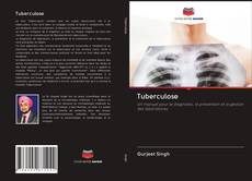 Capa do livro de Tuberculose 