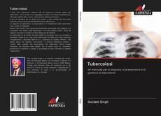 Bookcover of Tubercolosi