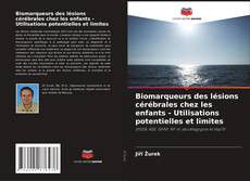 Bookcover of Biomarqueurs des lésions cérébrales chez les enfants - Utilisations potentielles et limites