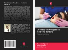 Capa do livro de Controlo de infecções na medicina dentária 
