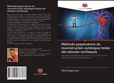 Méthode gasparyenne de reconstruction autologue totale des valvules cardiaques kitap kapağı