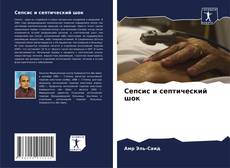 Capa do livro de Сепсис и септический шок 